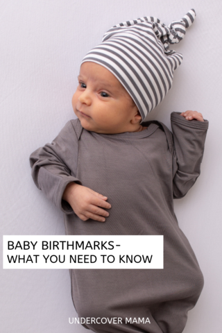 All About Baby Birth Marks!